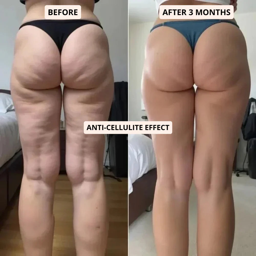 3D Sculpting Anti-Cellulite Leggings