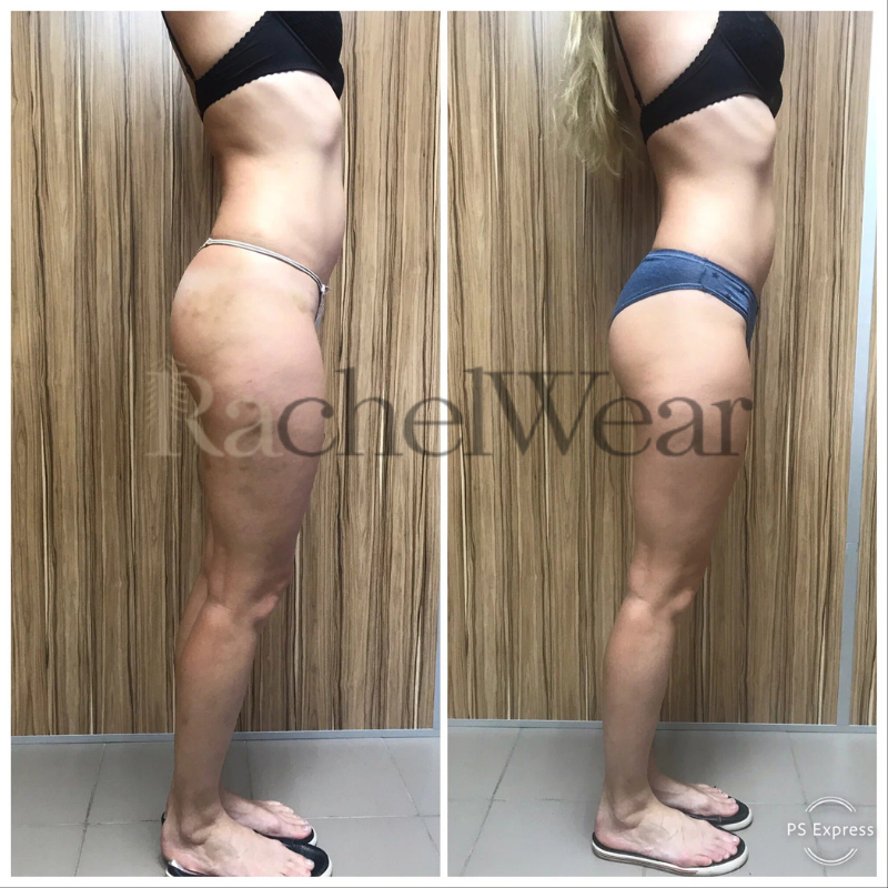 Before/After Image