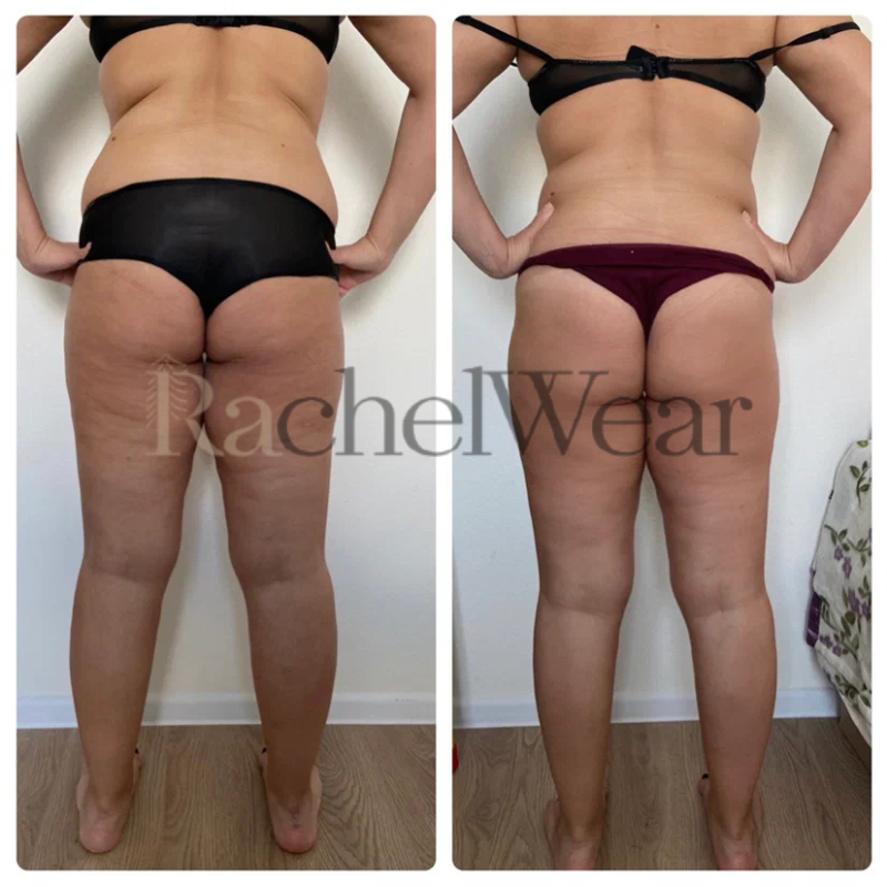 Before/After Image