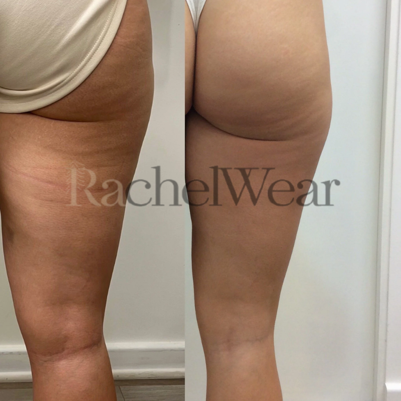 Before/After Image