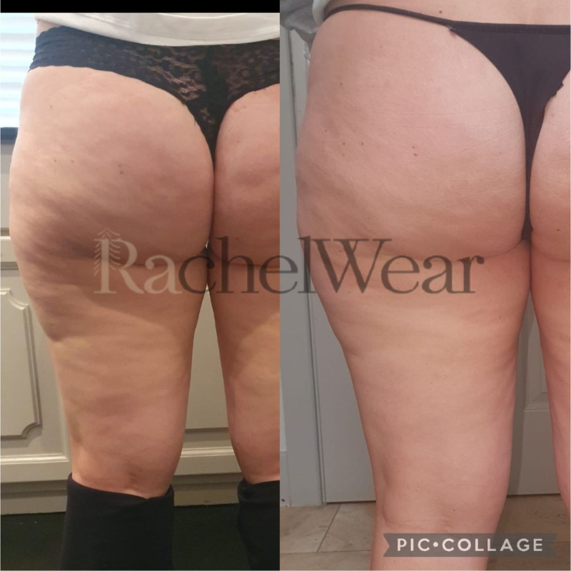 Before/After Image